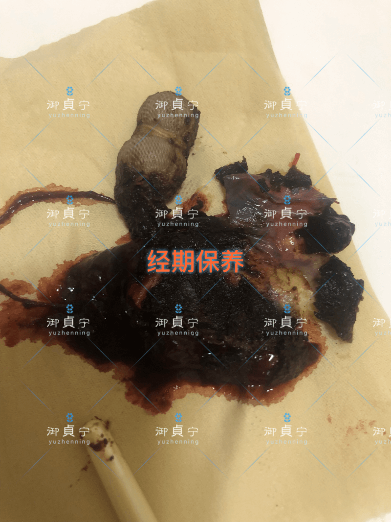 调理宫寒排出物：