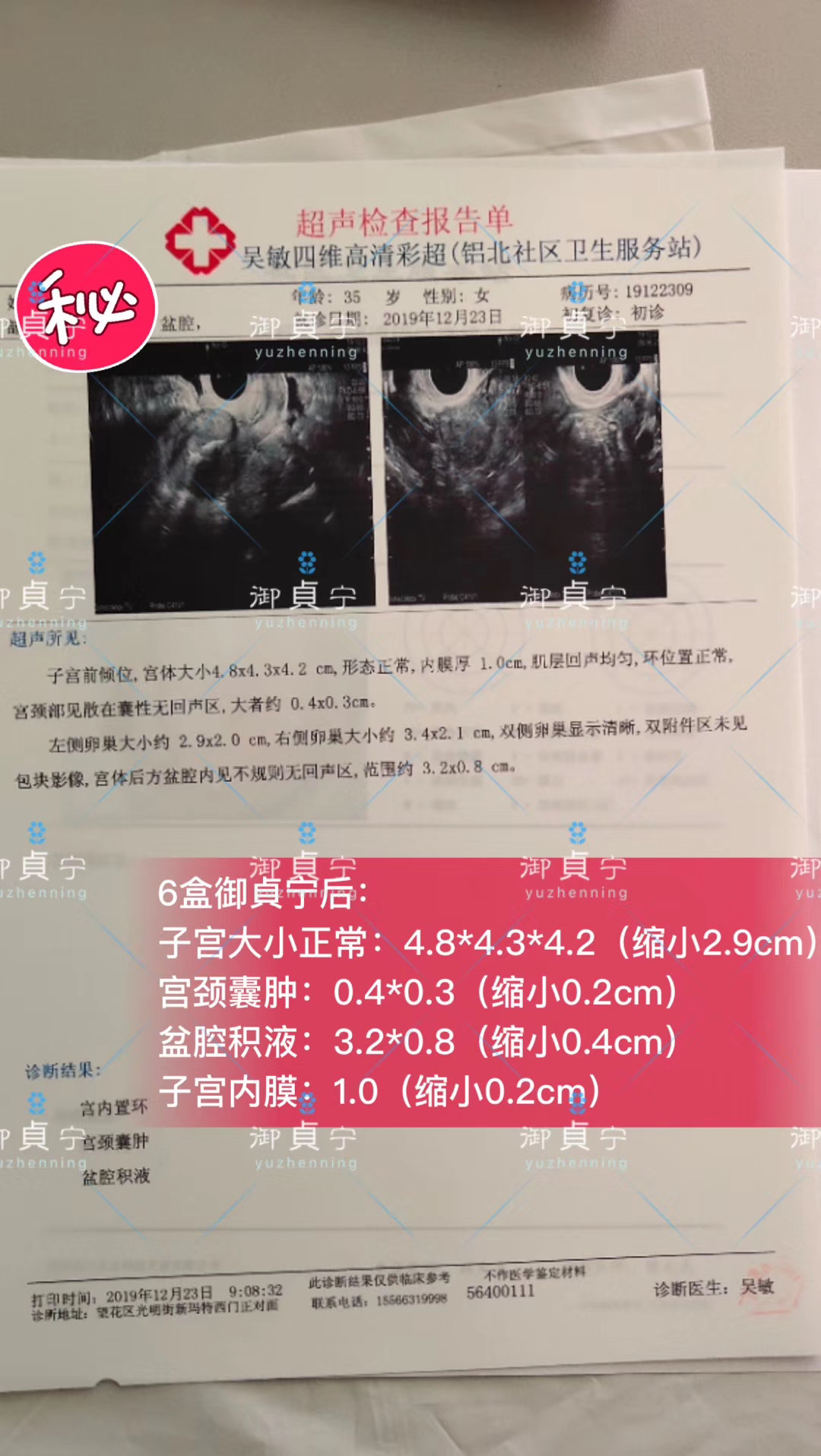 御貞宁前6盒后的数据对比