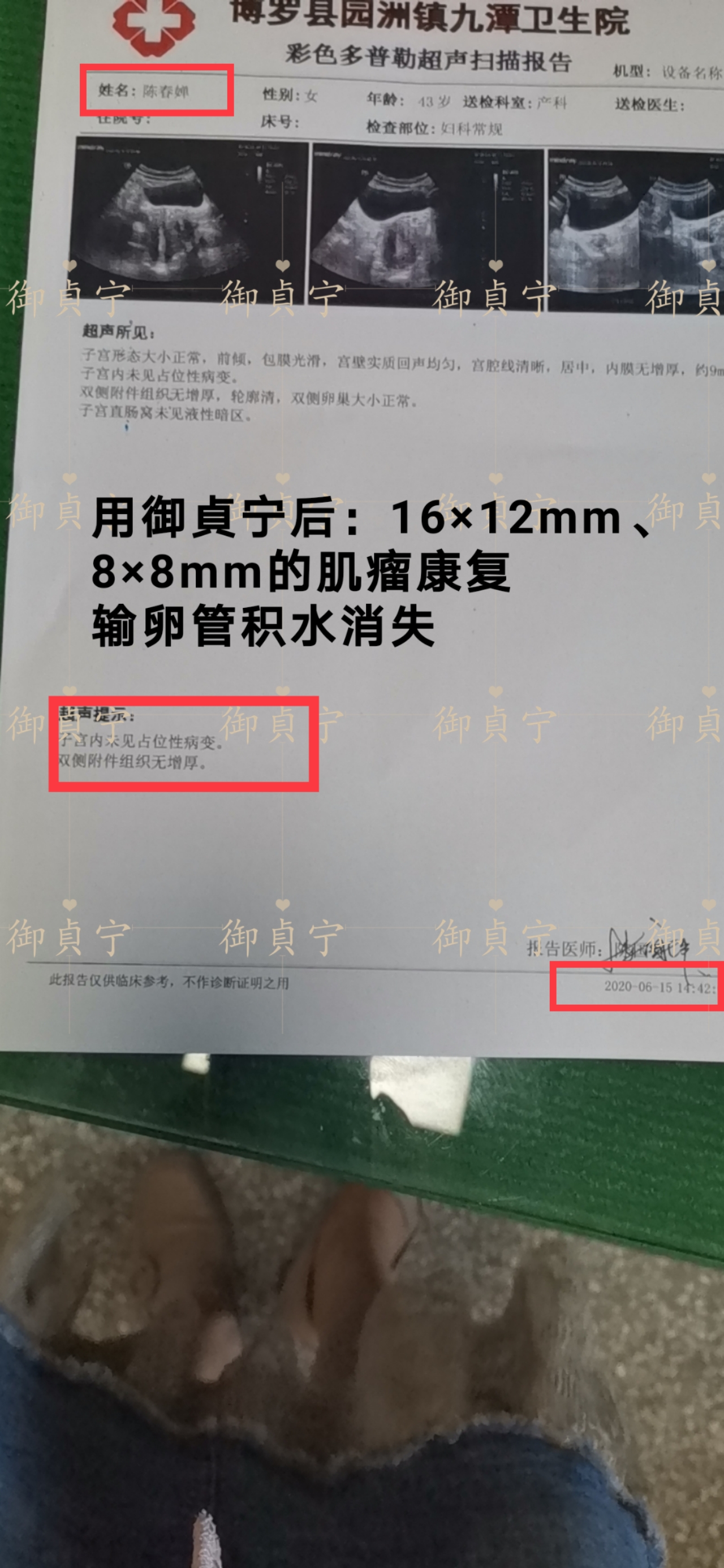 肌瘤、输卵管积水、细菌性阴道炎