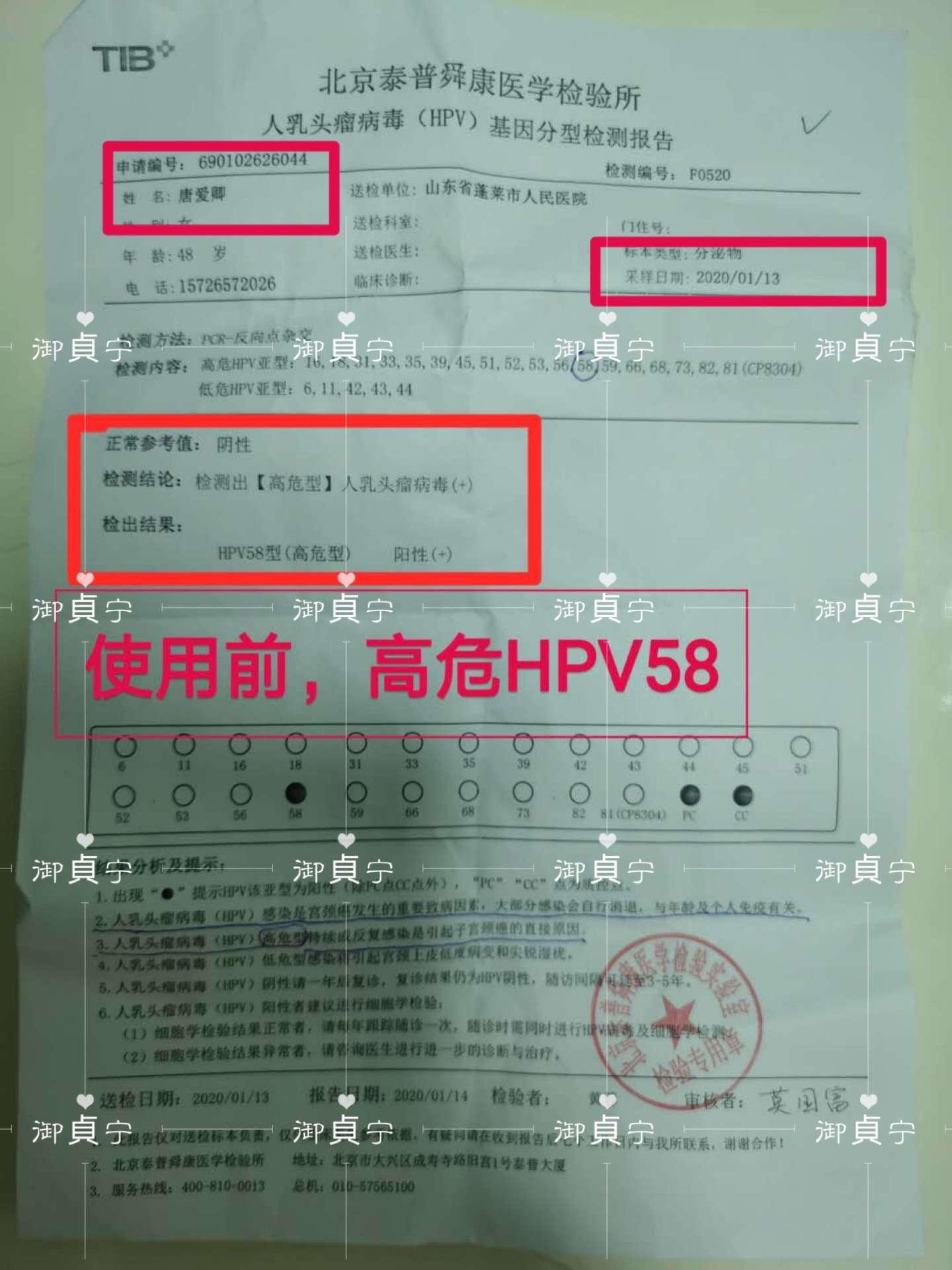 HPV58转阴康复盆腔静脉淤血也康复了