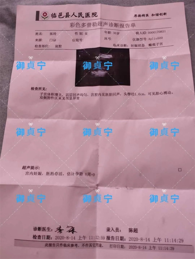 张玲的实名制反馈.多囊卵巢+一侧输卵管切.做过宫外孕手术