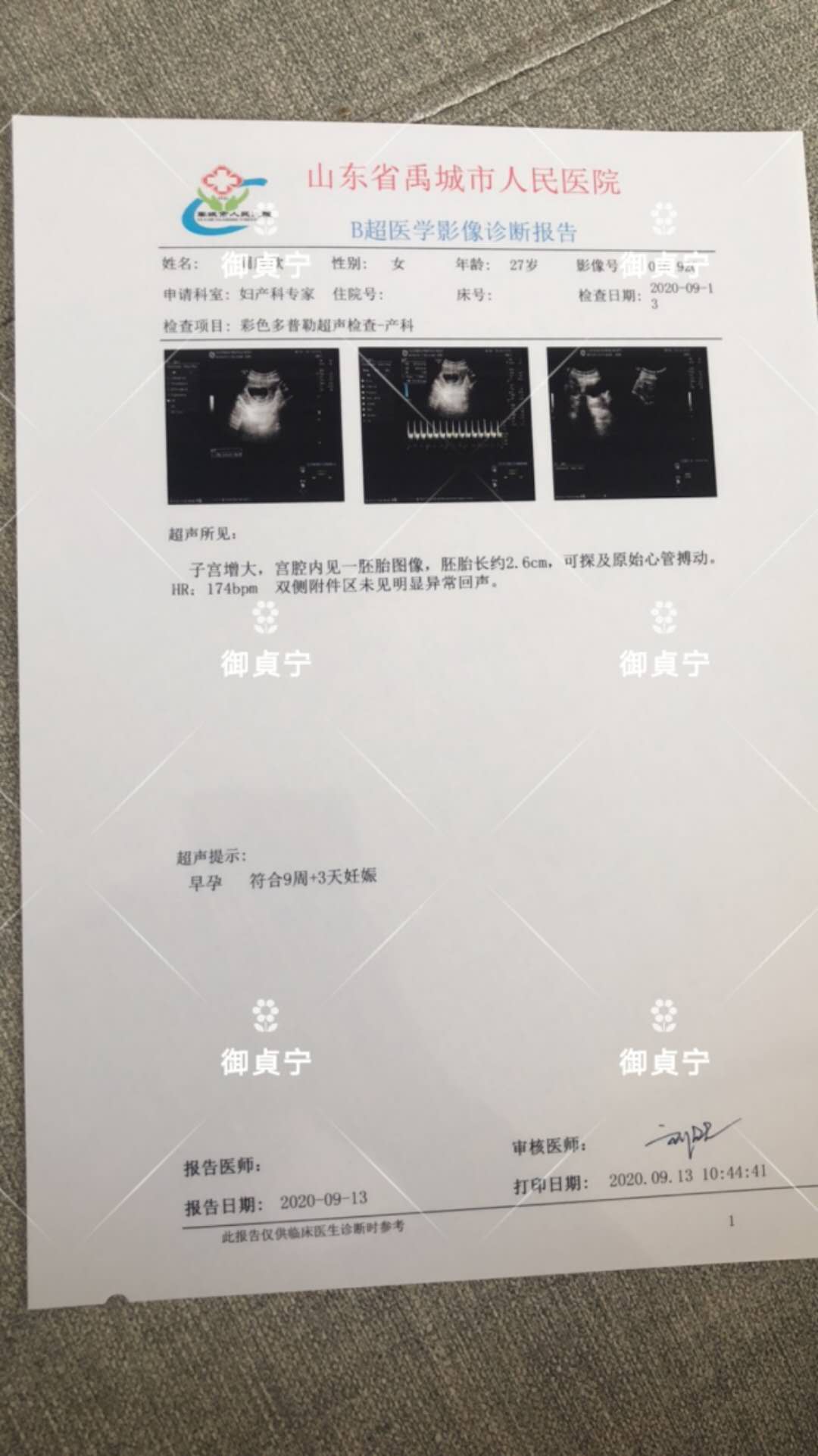 顾客备孕2年没有成通过御貞宁调理了宫寒、湿寒体质