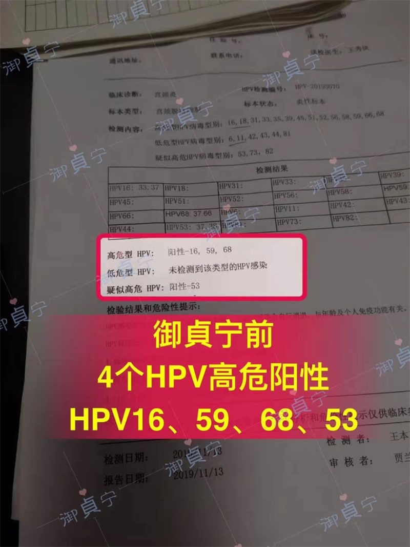 高危HPV16、59、68、53同步转阴乳腺增生脸上的斑没了