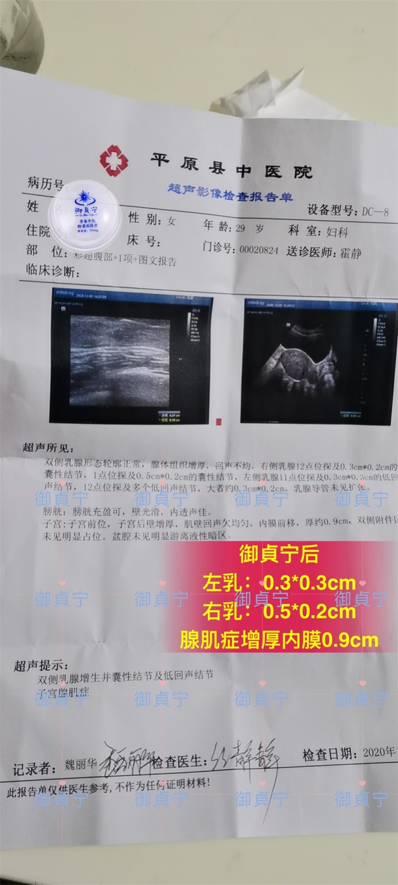 御貞宁【腺肌症】异病同调用单据数据说话