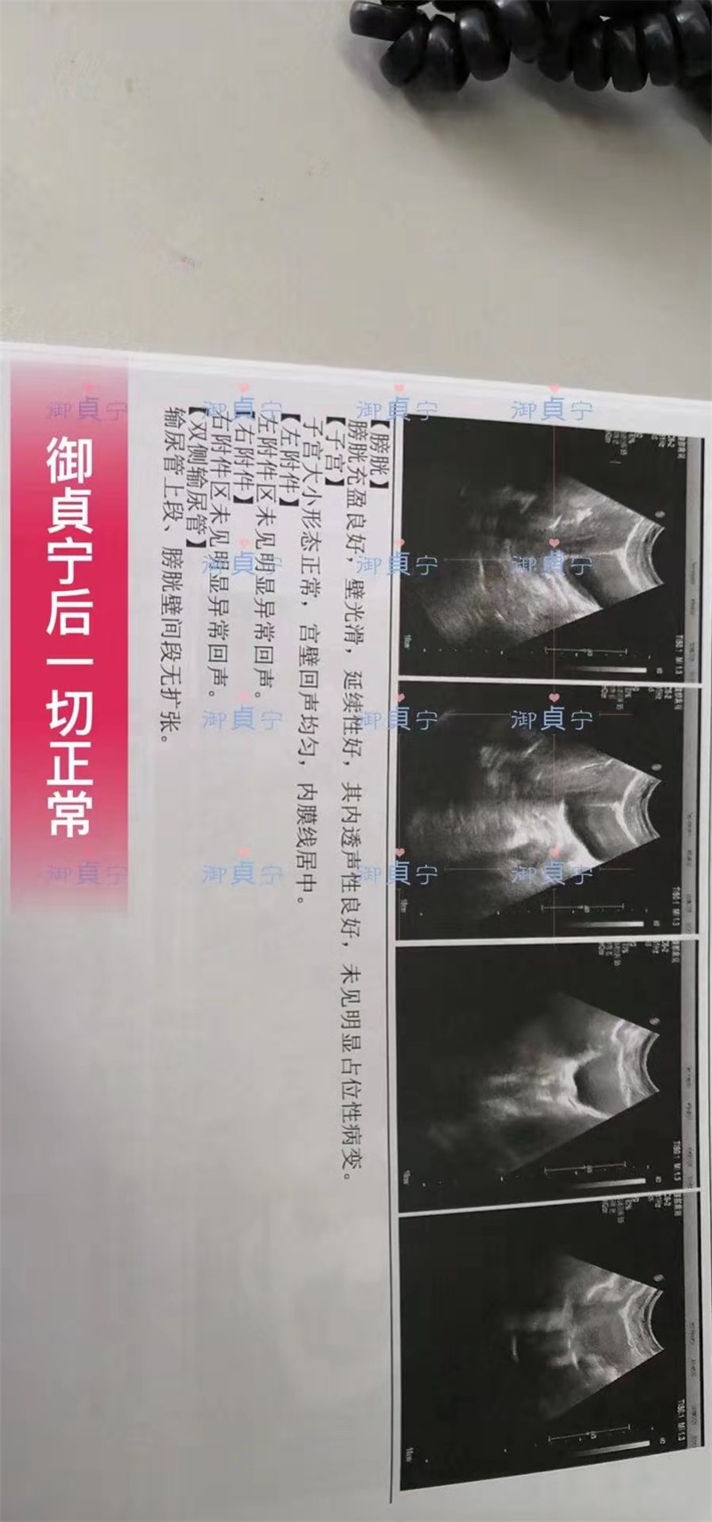 御貞宁后一切【检查正常】 —这就是御貞宁能给你的健康