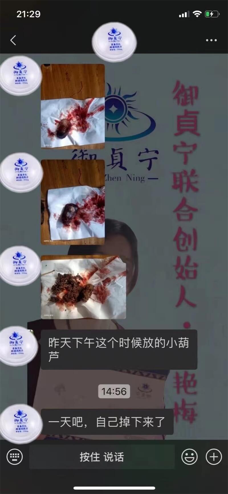 ️简单相信的福报 ️月经周期以前四五十天，现在30天左右