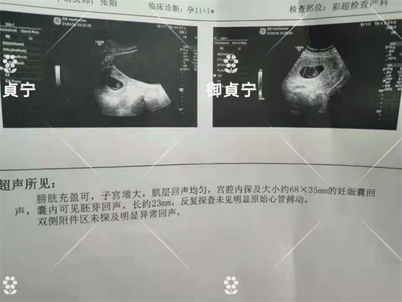 结婚【七年不孕】我御貞宁终于完成了她的妈妈梦
