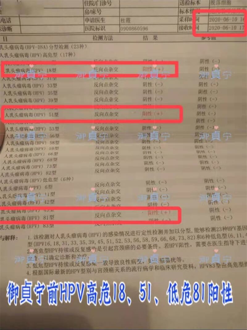 四个疗程葫芦后:【HPV18、HPV51、HPV81三项同步转阴】