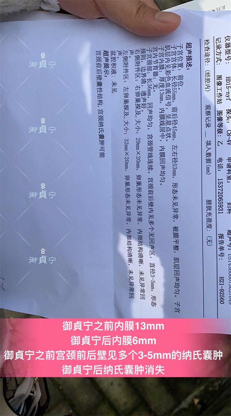 御貞宁之前后【子宫内膜增厚➕多发宫颈囊肿】康复的检查