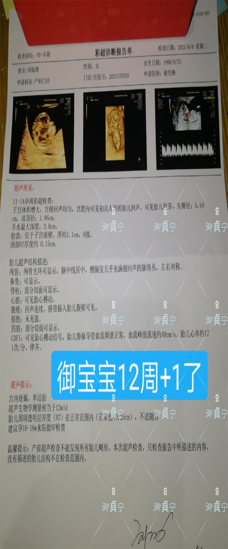 御貞宁【保胎成功 】——宫内好孕12+1周