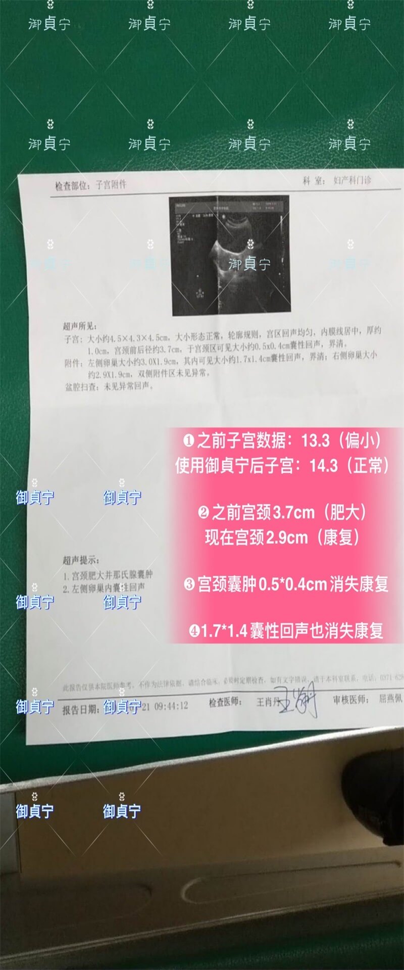 御貞宁️项康复案例 ——【宫颈囊肿】