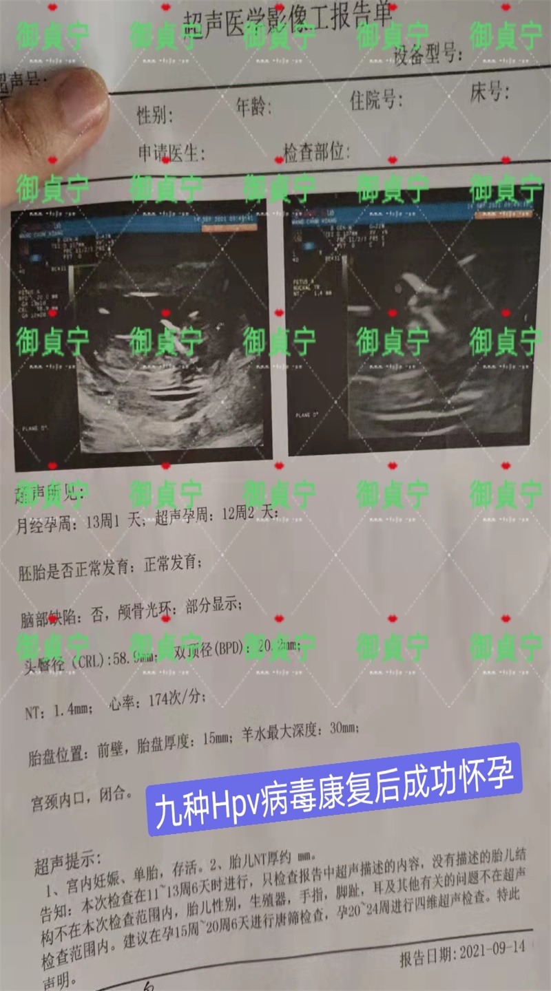 【九项HPV】转阴后成功备孕御貞宁又圆满了一个家庭～