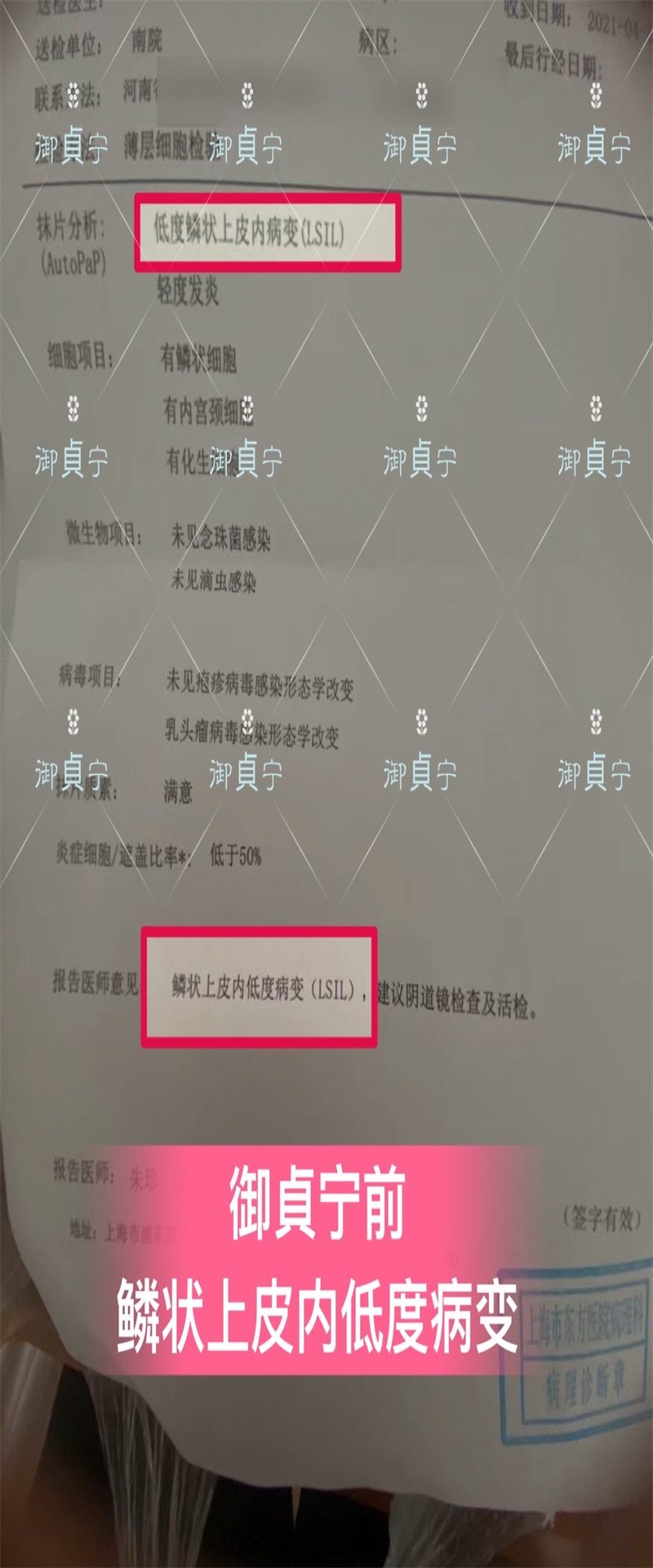御貞宁一疗程【癌前病变康复➕HPV转阴】功德无量