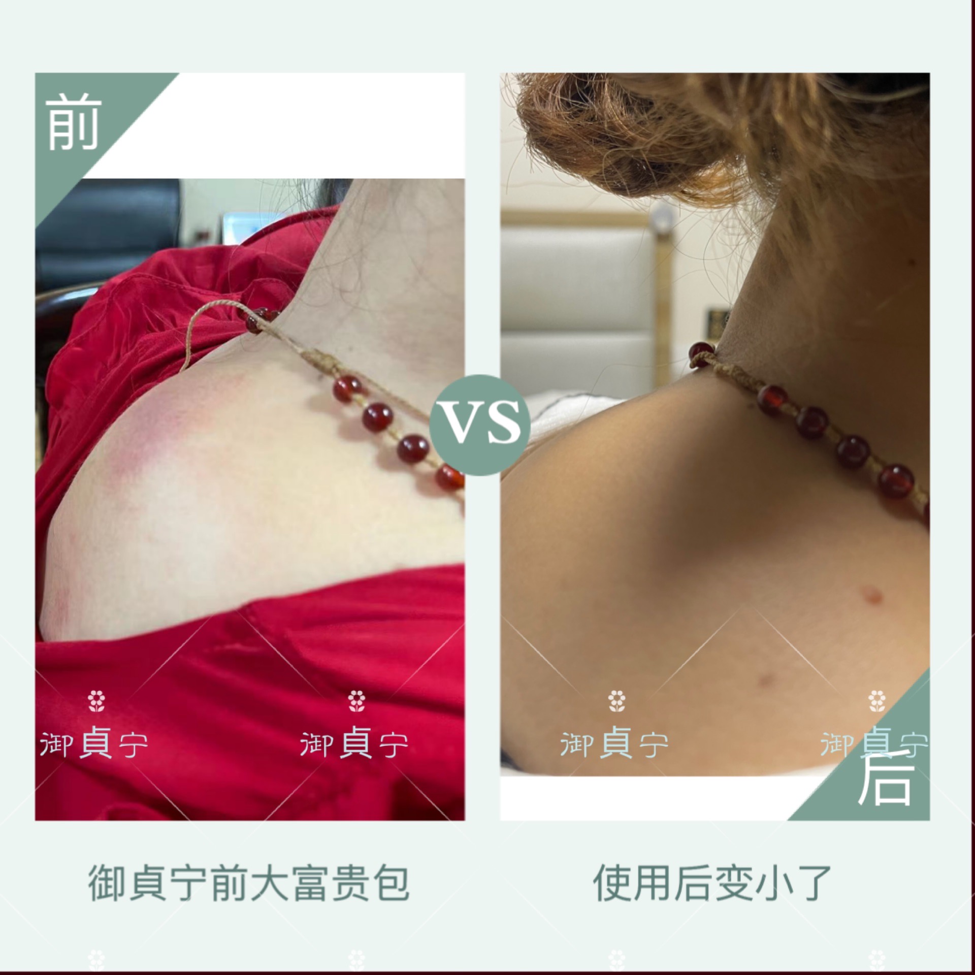  御貞宁大葫芦药水调理【富贵包】的效果！