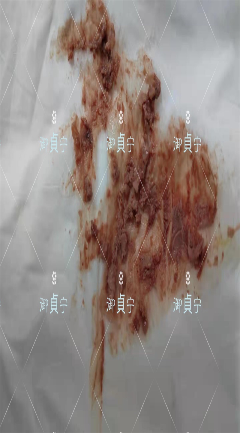 【月经颜色、量】都变好了这就是御貞宁给的全方位健康
