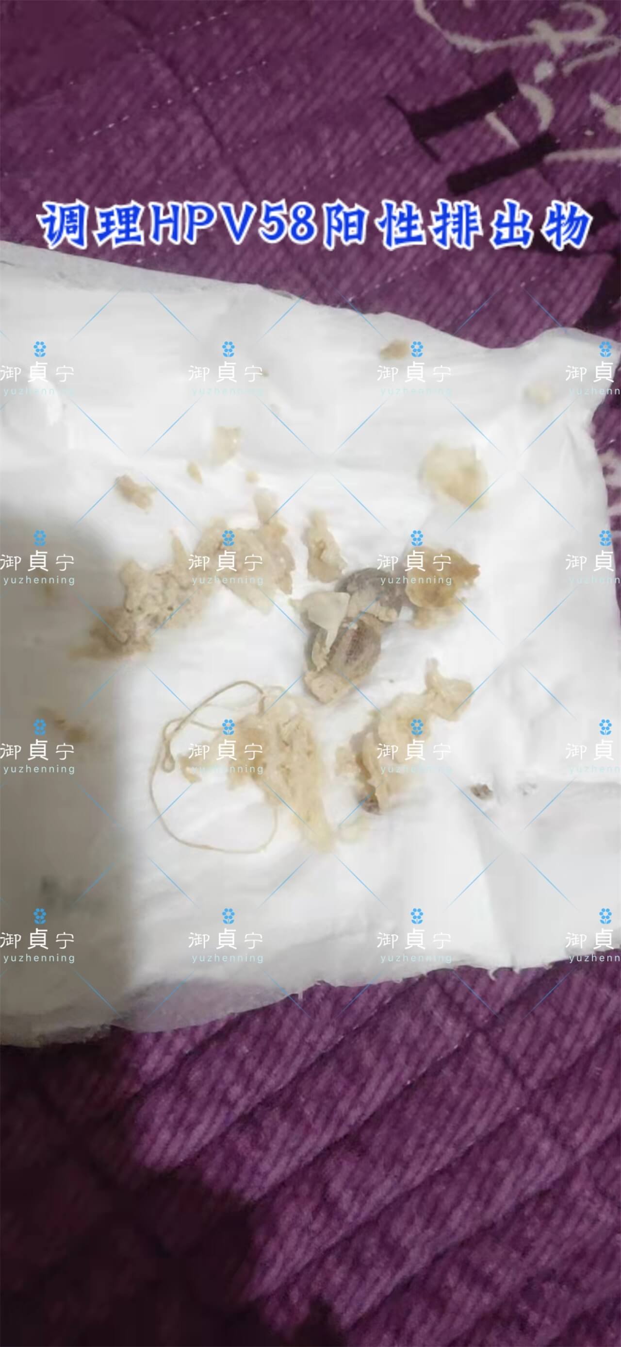 3✔️大姑姐咨询篇 ——检查出HPV58阳性！ ✔️使用御貞宁前