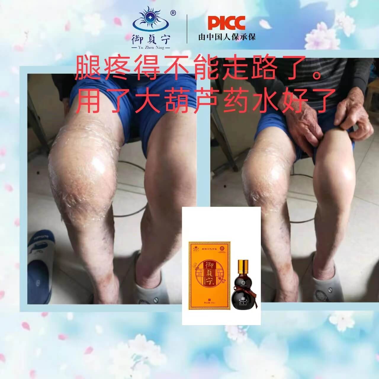 大葫芦水调理腿疼